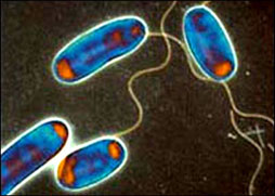 Legionella Risk Assessment